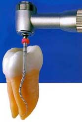 endo-31.jpg
